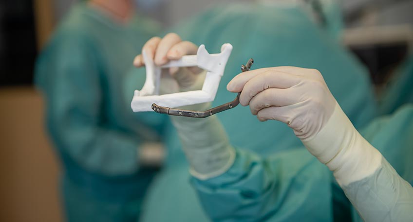 CAD/CAM-gefertigten Sägeschablonen wird zudem die Operationszeit verkürzt und die Passgenauigkeit erhöht. Die Operationsmethode ist allerdings nicht für jeden Patienten geeignet. Die körperliche Konstitution für eine achtstündige Operation muss ebenso vorhanden sein wie eine entsprechende Blutversorgung des Beins. „Wenn die Gefäße im Bein nicht ausreichend stark sind, riskieren wir eine unzureichende Durchblutung des Fußes. All das muss im Vorfeld mittels einer CT-Angiografie untersucht und abgeklärt werden“, sagt Scheer. Grundsätzlich kann jeder gesunde Mensch auch ohne Teile des Wadenbeins gut leben. Das eigentliche Gewicht liegt auf dem parallel verlaufenden Schienbein. „Das Wadenbein verleiht uns etwas mehr Stabilität.“ Dass der Patient aus Hameln mit einer Krücke zur Nachuntersuchung kommt, lässt Dr. Scheer dann aber doch aufhorchen. Doch der Patient beruhigt: „Ich habe mir das Knie verdreht – auf der anderen Seite. Dem Wadenbein geht es gut – dem verbliebenen Teil im Bein und dem im Kiefer.“